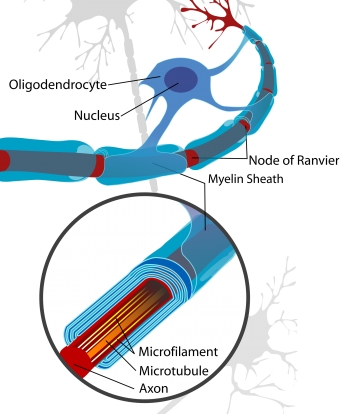 Thoughts on "Acute Flaccid Myelitis"