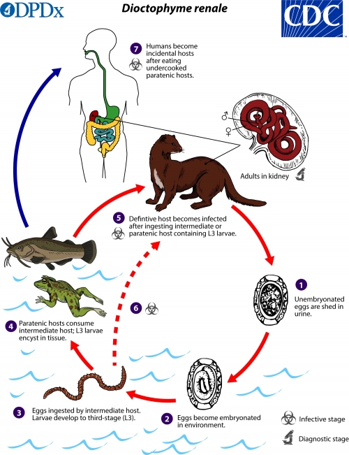 Connection between Kidney Stones &amp; Parasites?