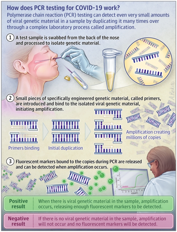 The COVID-19 RT-PCR Test: How to Mislead All Humanity. Using a “Test” To Lock Down Society